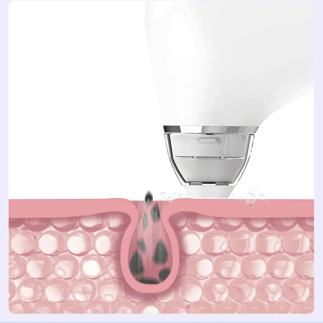 PoreVac Elite Skin Cleanser